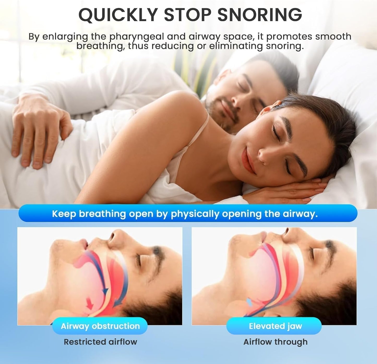 SilentEase™Sleep Mouthpiece™